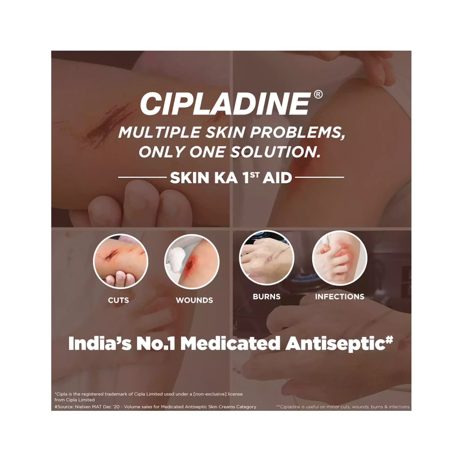 CIPLADINE OINT 25GM