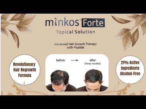 MINKOS FORTE TOPICAL SOLU